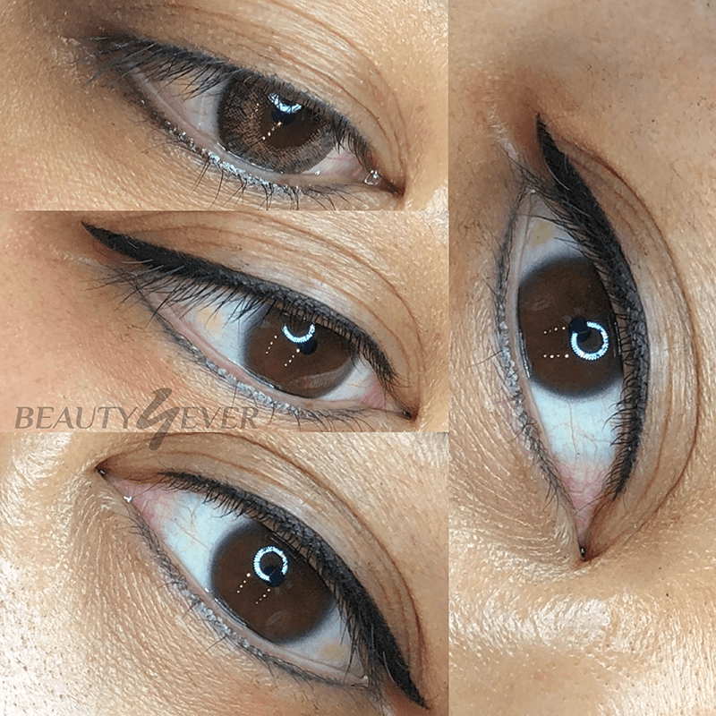 Eyeliner treatment