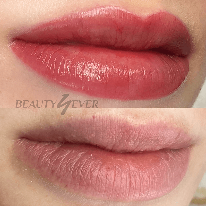 lip blush treatment